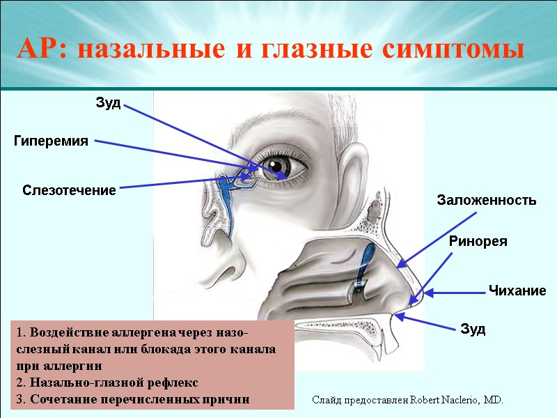 АР: назальные и глазные симптомы  Зуд Гиперемия Слезотечение Ринорея Заложенность Чихание Зуд 1.